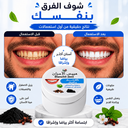مبيض الأسنان الطبيعي